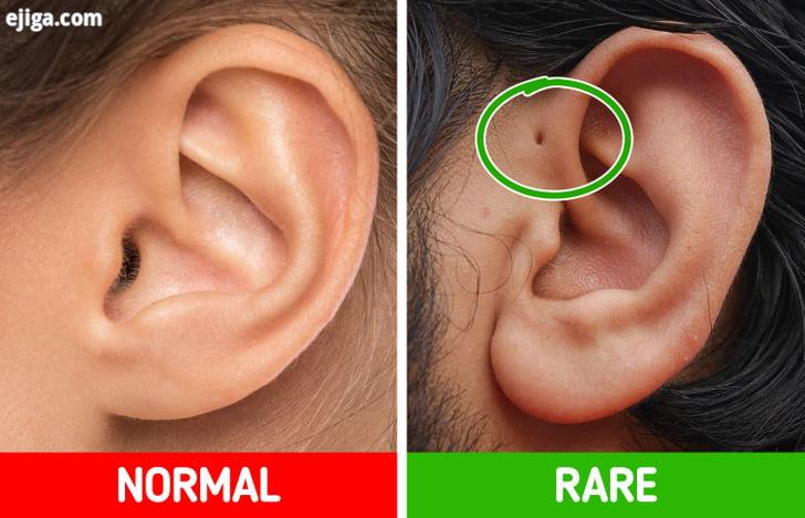 یک سوراخ کوچک در نزدیکی گوش، ویژگی بدنی خاص