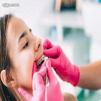 درباره ناهنجارهای دندانی چه می دانید؟