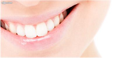 کدام نوع از سفید کننده‌‌های دندان، اثر کمتری دارند؟