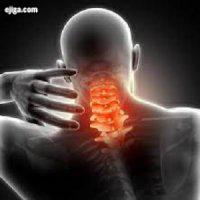 آرتروز گردن "ساییدگی مهره های گردن" چه علائمی دارد؟
