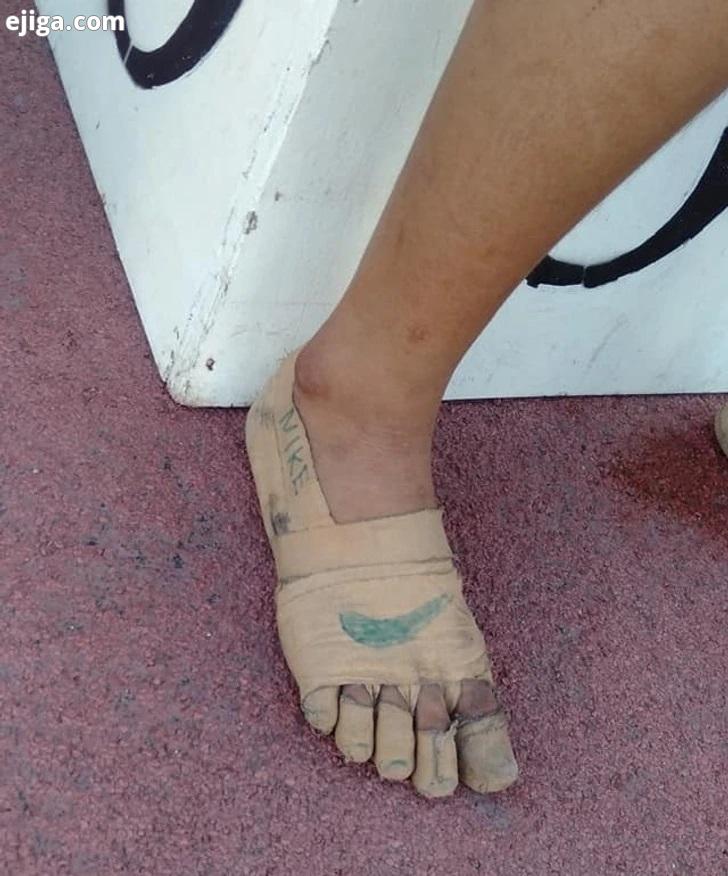 دختر فیلیپینی که با کفشهای نقاشی شدهبرنده ۳ مدال طلا شد