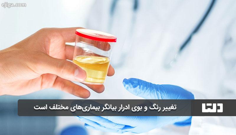 بیماری های مختلف عامل تغییر رنگ و بوی ادرار هستند
