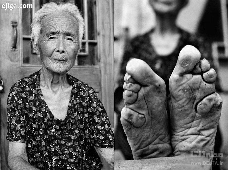 بستن پا‌ها در چین