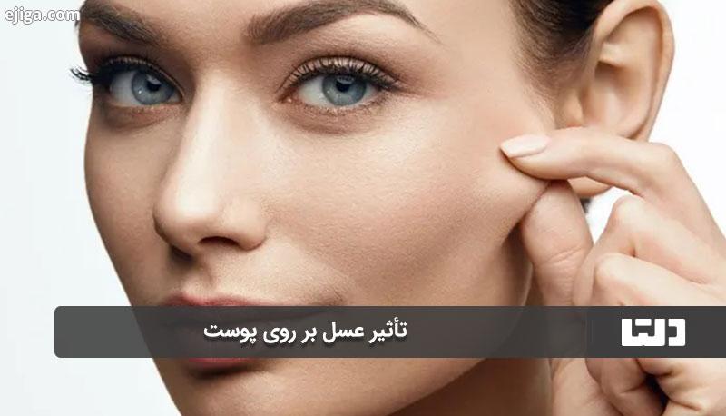 تأثیر عسل بر روی پوست