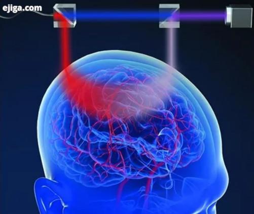 ارزیابی آسیب‌های مغزی با کمک نور،اخبار پزشکی،خبرهای پزشکی