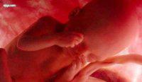 نگرانی‌ها از حذف غربالگری جنین برای چیست؟ / تولد سالانه ۳۵ هزار کودک معلول در ایران