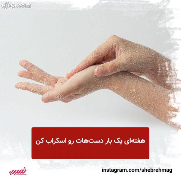 خشکی پوست دست