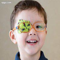 تنبلی چشم در کودکان از چه زمانی قابل تشخیص است؟